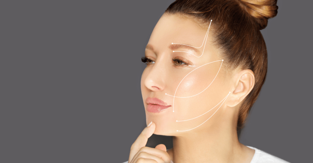 The New Face Lift PDO Thread Lift San Diego SD Botox