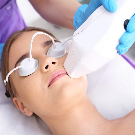 laser acne treatment