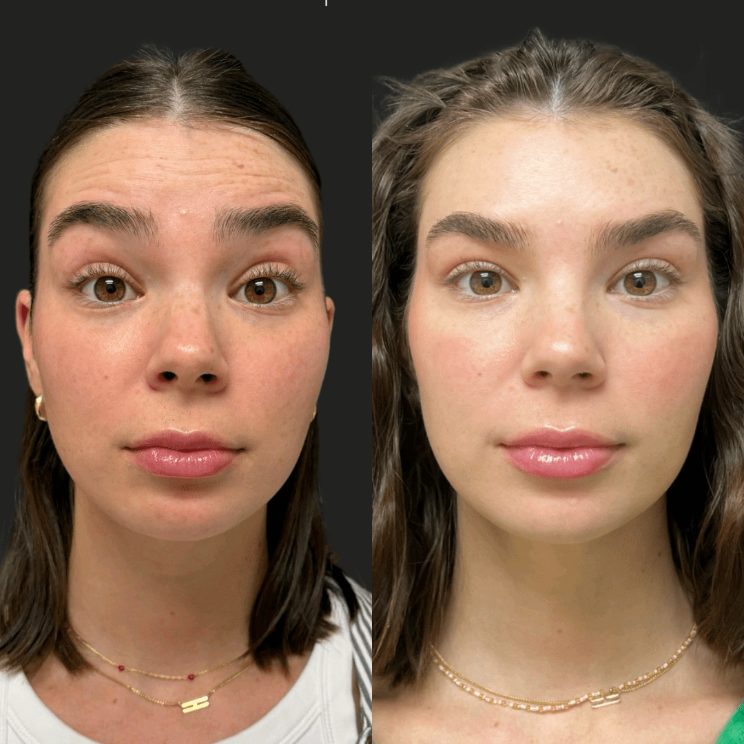 Best Before And After Photos Best Before And After Photos