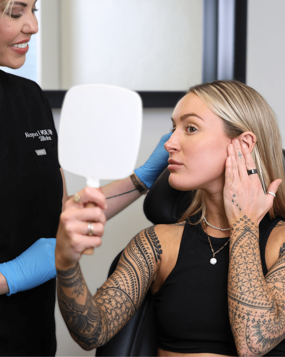 Natural dermal filler results at SDBotox in San Diego