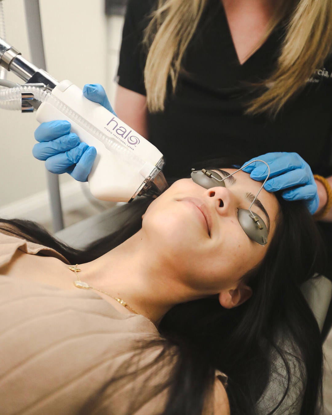 skin tightening treatments in San Diego