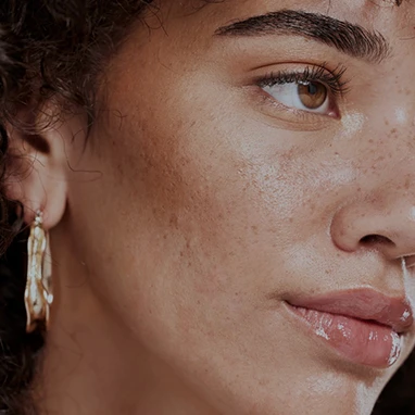 Close-up side portrait of a woman&rsquo;s face highlighting natural skin texture and complexion