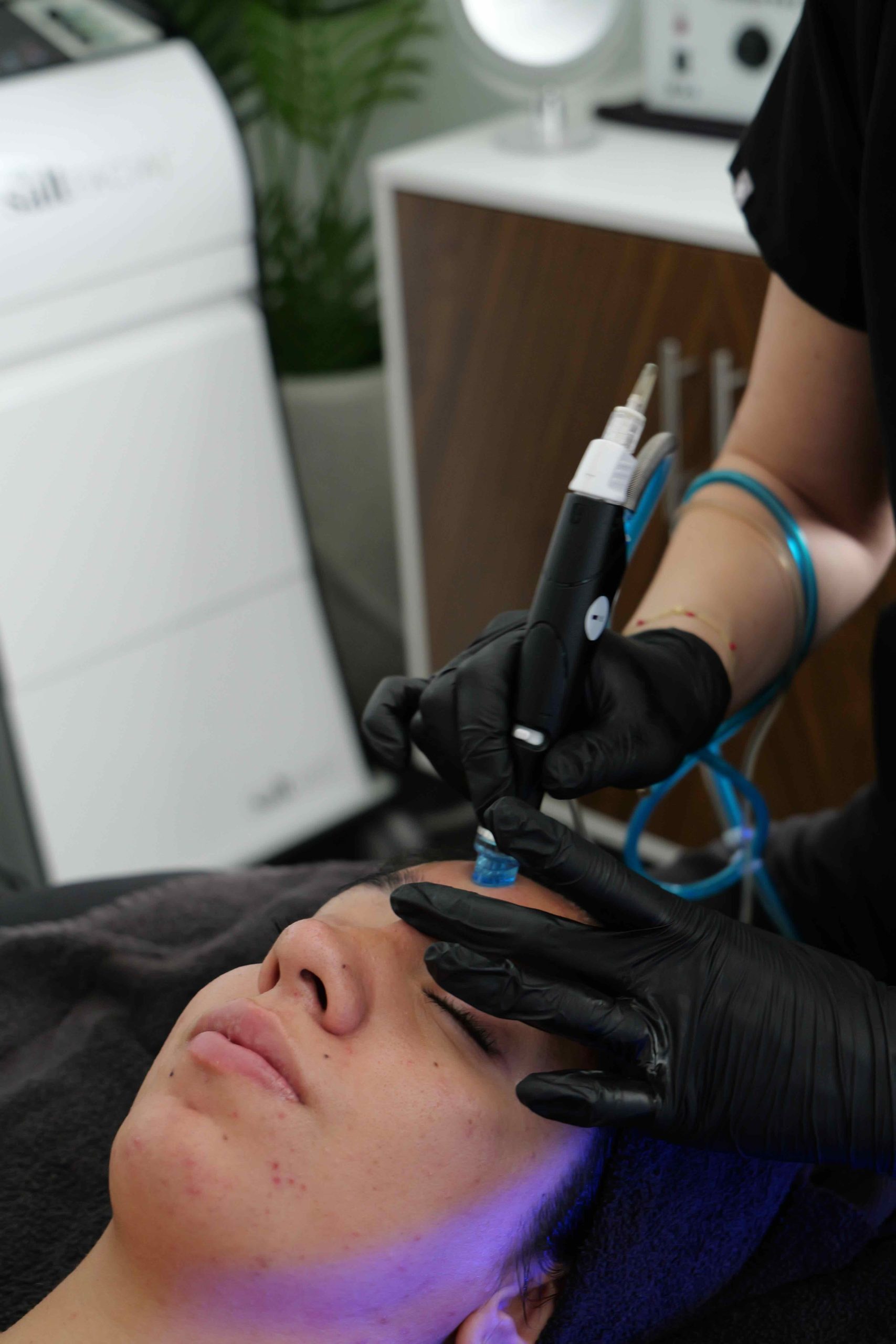 HydraFacial
